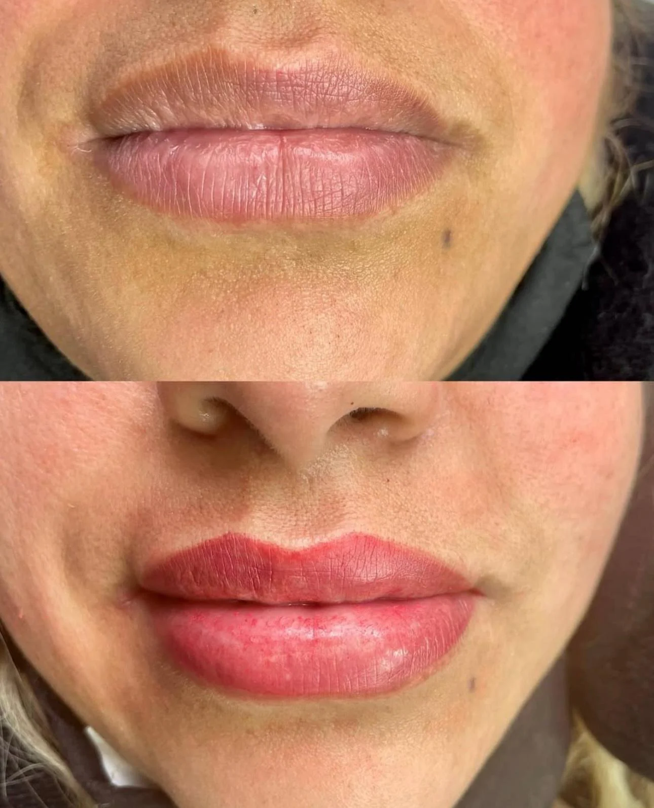 micropigmentación de labios